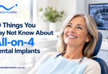 10 Things You May Not Know About All-on-4 Dental Implants
