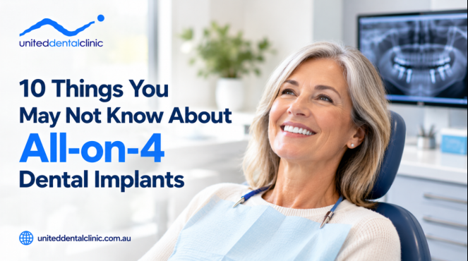 10 Things You May Not Know About All-on-4 Dental Implants