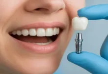 Dental Implants Newcastle Success Stories That Patients Are Talking About