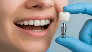 Dental Implants Newcastle Success Stories That Patients Are Talking About